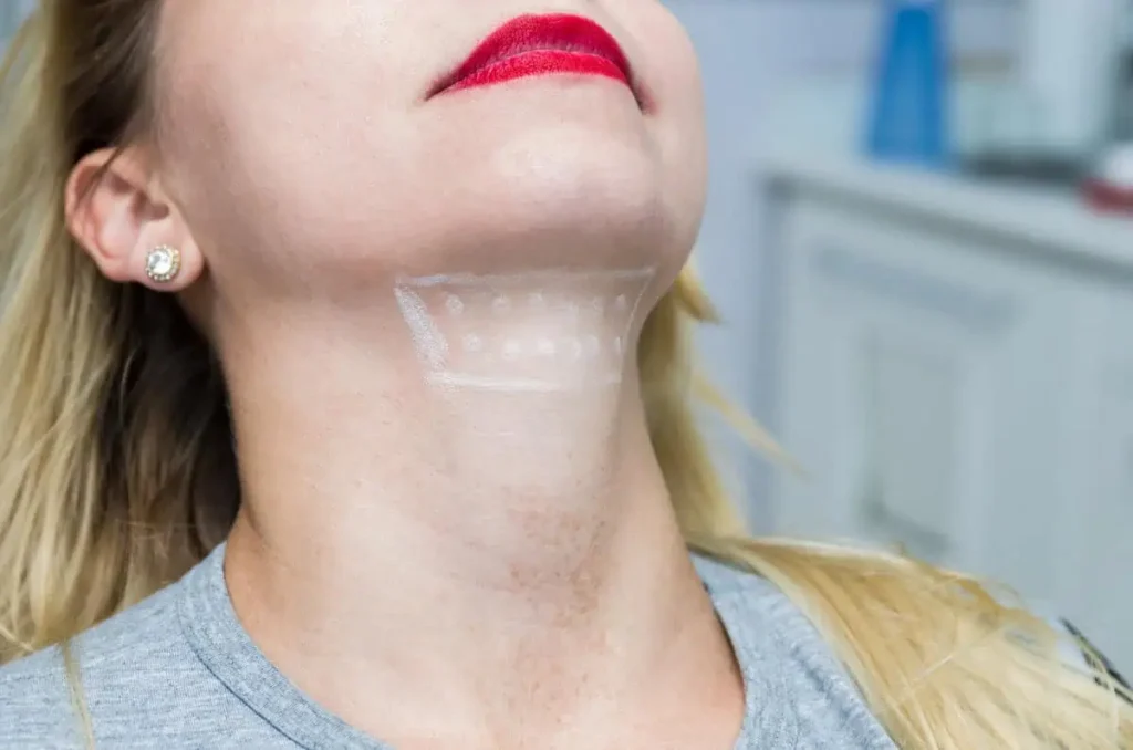 Kybella by LJ Macro Med Spa, Corona, CA