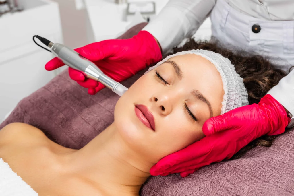 Microneedling in Corona, CA | Marco Med