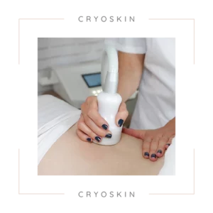 CryoSkin Treatment at Marco Med in Corona, CA