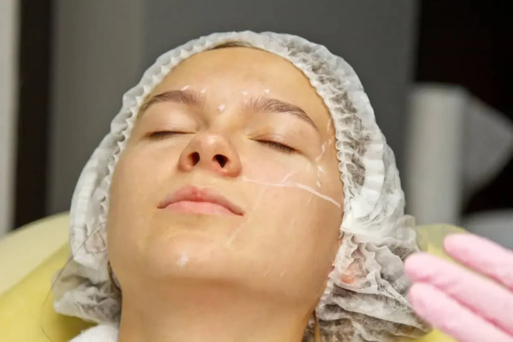 kybella by The Macro Med Spa in Corona, CA